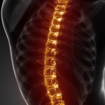 Spinal Compression Fractures - A Common Cause of Back Pain