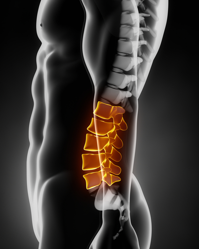 Discogenic Low Back Pain and Discograms