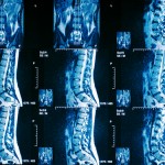 Taking Pictures of Your Spine