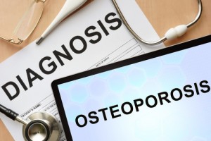 Fragile Bones: Osteoporosis Discussion