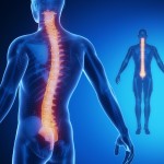 Tips to Better Your Exercise With Lumbar Herniated Disc