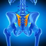 Dr. Richard A. Kube: 12-month Results of Clinical Study on Sacroiliac Joint Fusion