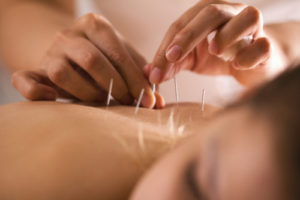Could-Acupuncture-Help-Relieve-Chronic-Back-Pain-300x200